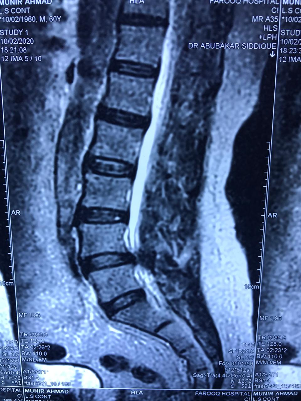 X-ray