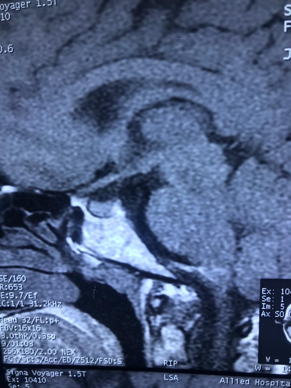 X-ray