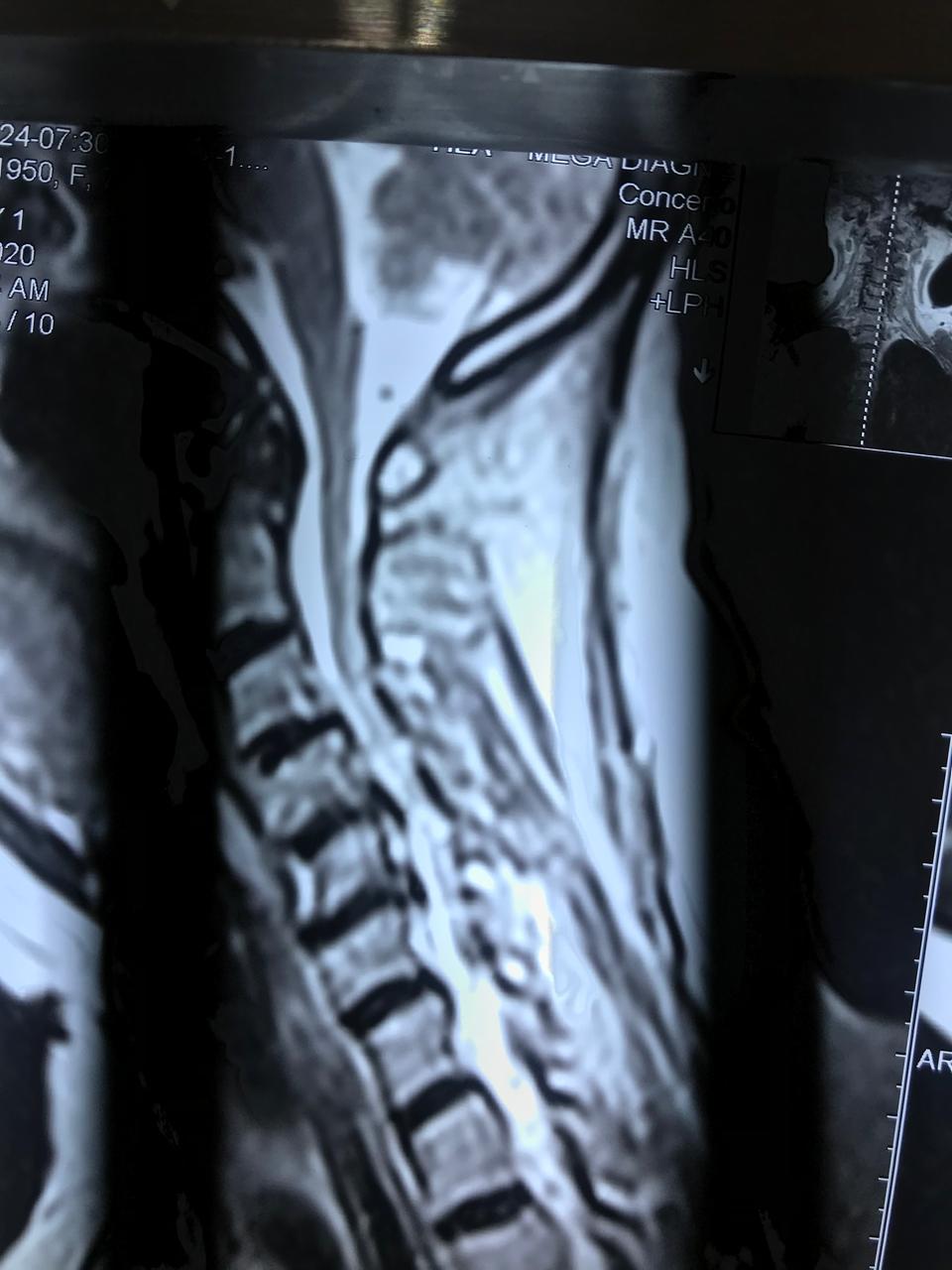 X-ray
